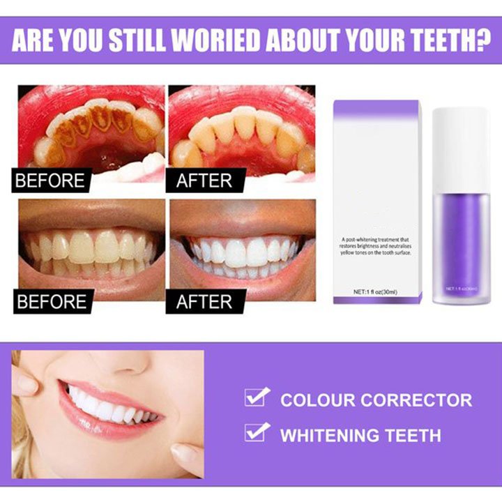 TK-LAST DAY 48% OFF🔥Teeth Colour Corrector Serum